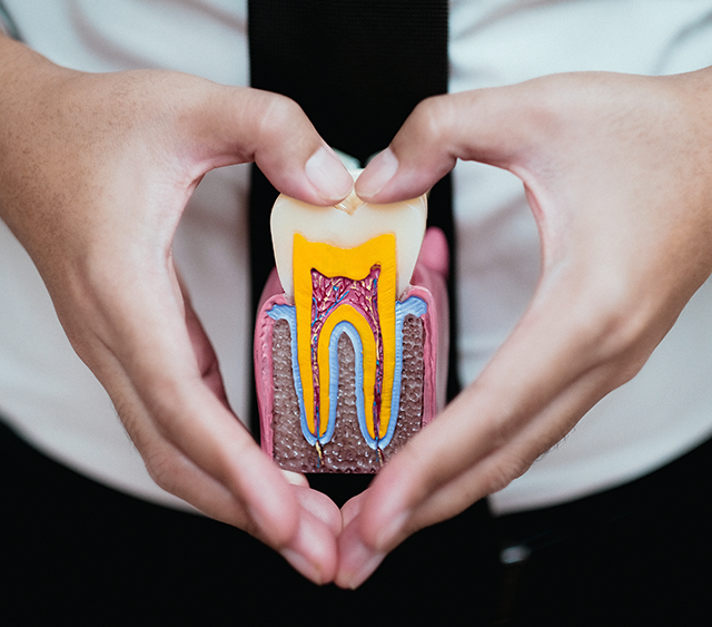 Root canal Treatment London Root Canal Near Me