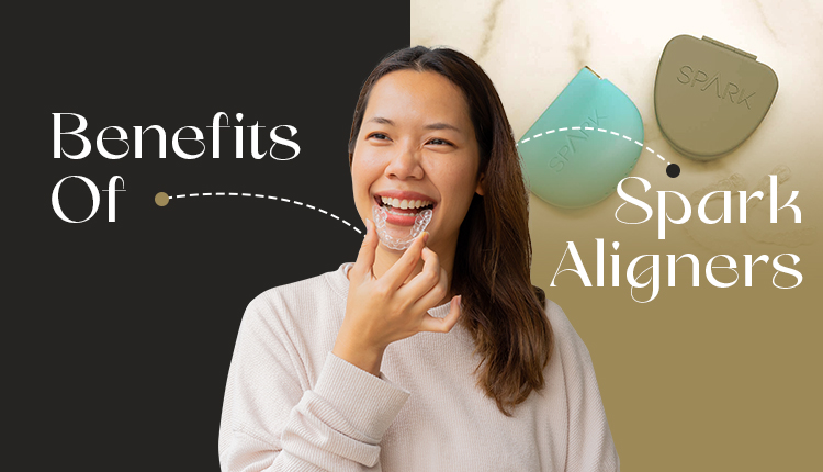 Benefits Of Spark Aligners