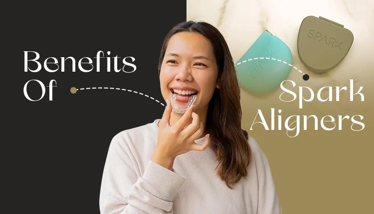 Benefits Of Spark Aligners