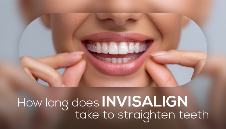 How Long Does Invisalign Take to Straighten Teeth