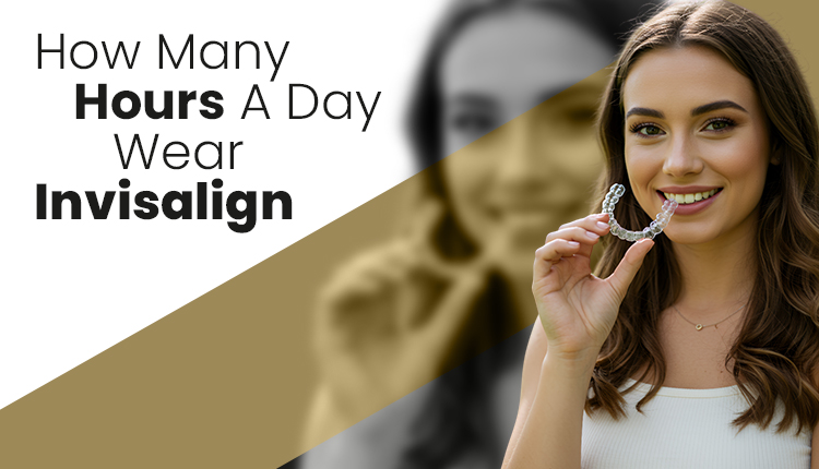 How Many Hours A Day Wear Invisalign
